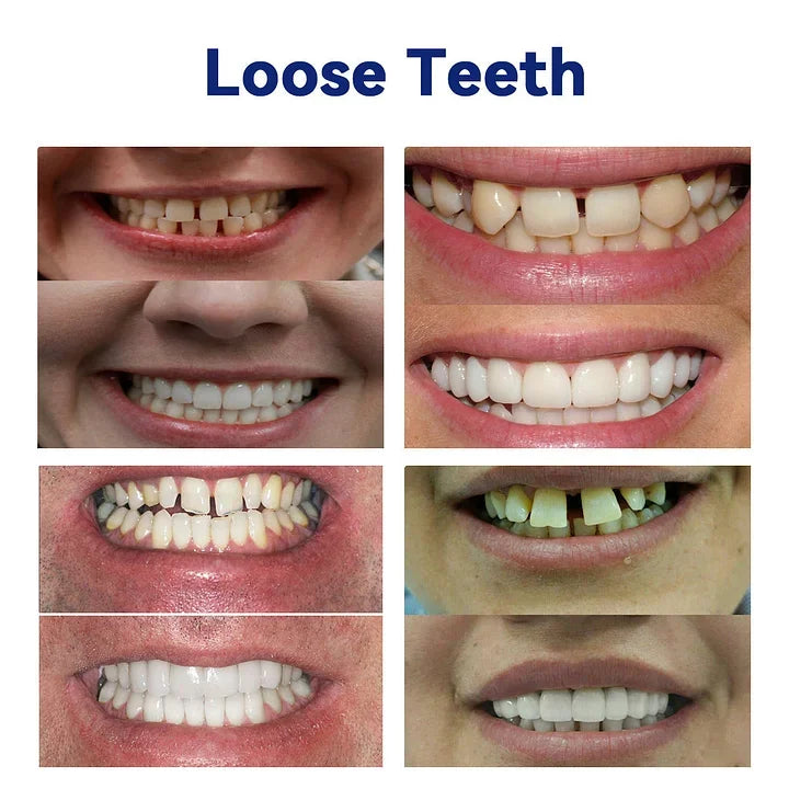 DentureSet Pro | Complete Denture Set