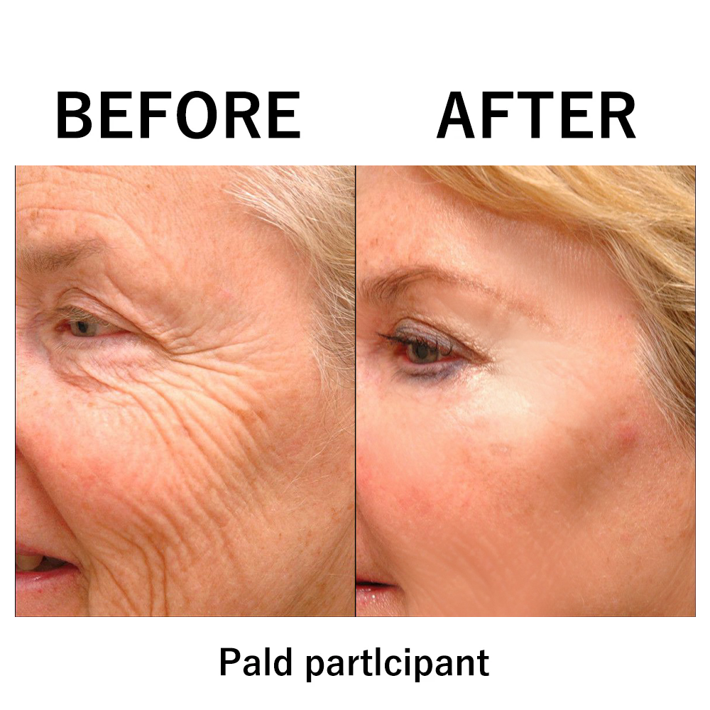 InstantLift™ | Instant Temporary Facial Tightening Cream