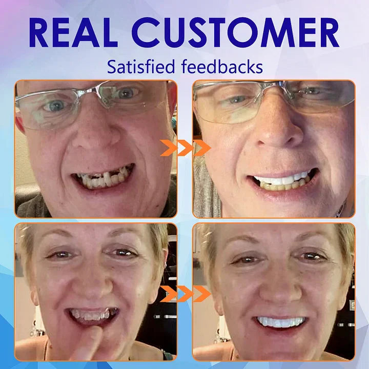 DentureSet Pro | Complete Denture Set