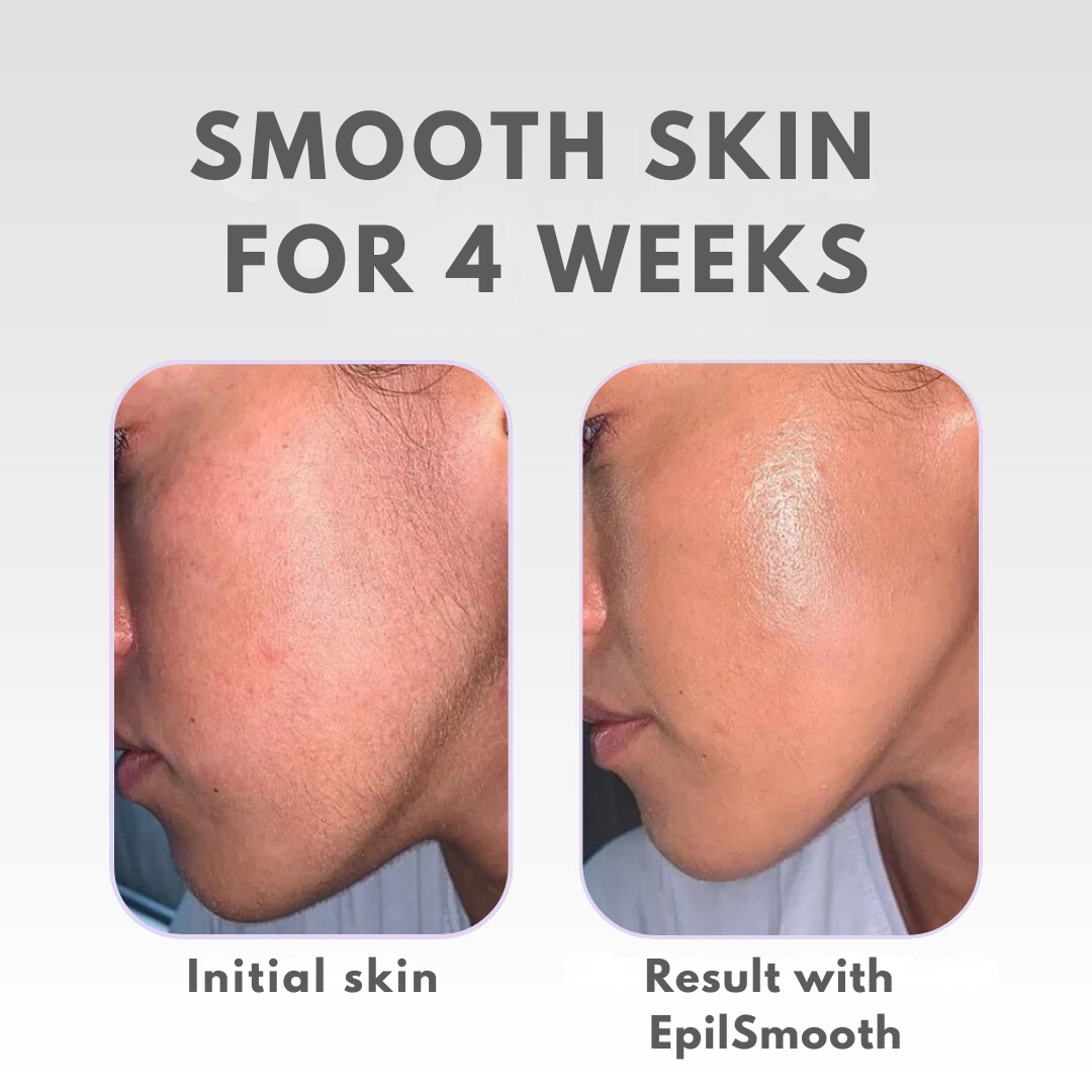 EpilSmooth™ | Portable Facial Hair Remover