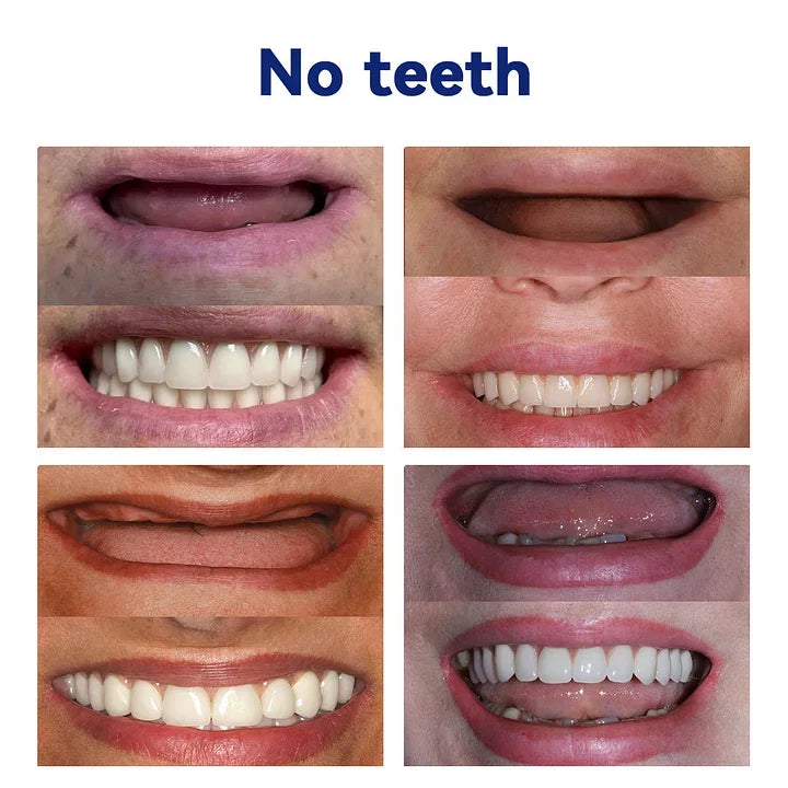 DentureSet Pro | Complete Denture Set