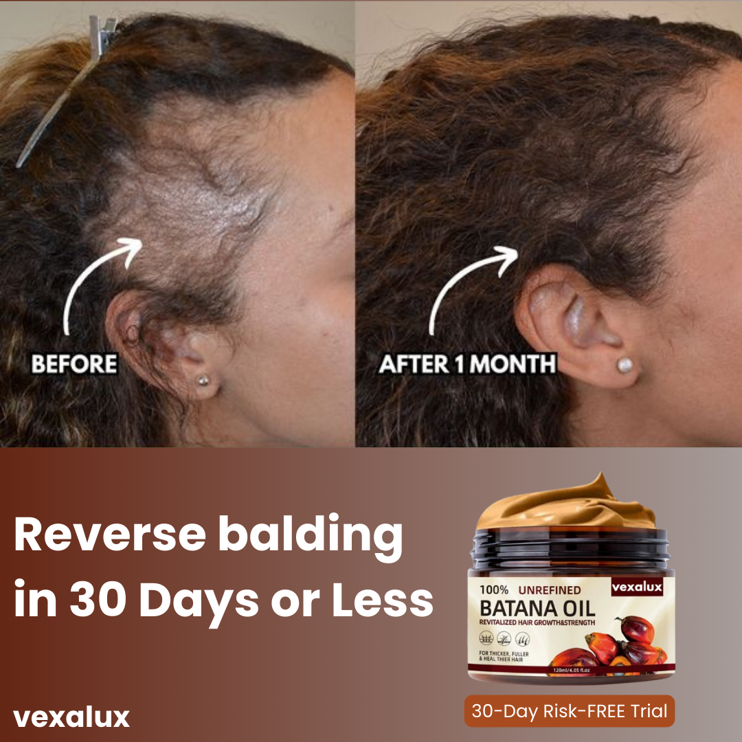 Vexalux™ | 100% Unrefined Batana Oil