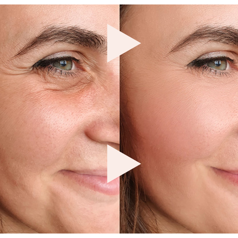 Rollift | The Roll-On Firming Treatment that Illuminates, Tightens, and Rejuvenates Your Gaze
