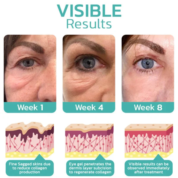 InstaCream™ | Anti-Dark Circles and Wrinkle Cream