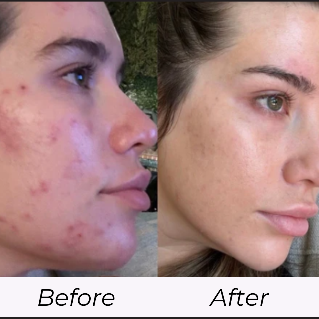 Medikalglow™ | Collagen-Infused Overnight Mask