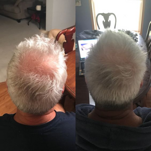 Purc™ | Natural Oil to Prevent Hair Loss