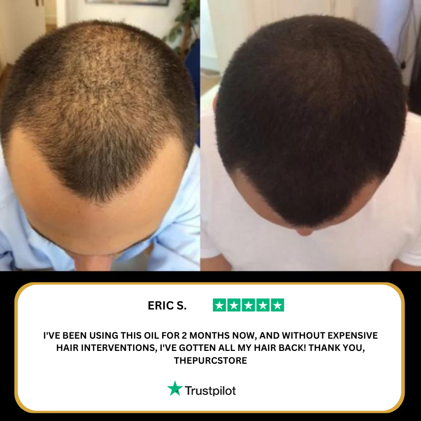 VitaBeam | Electric Scalp Massager