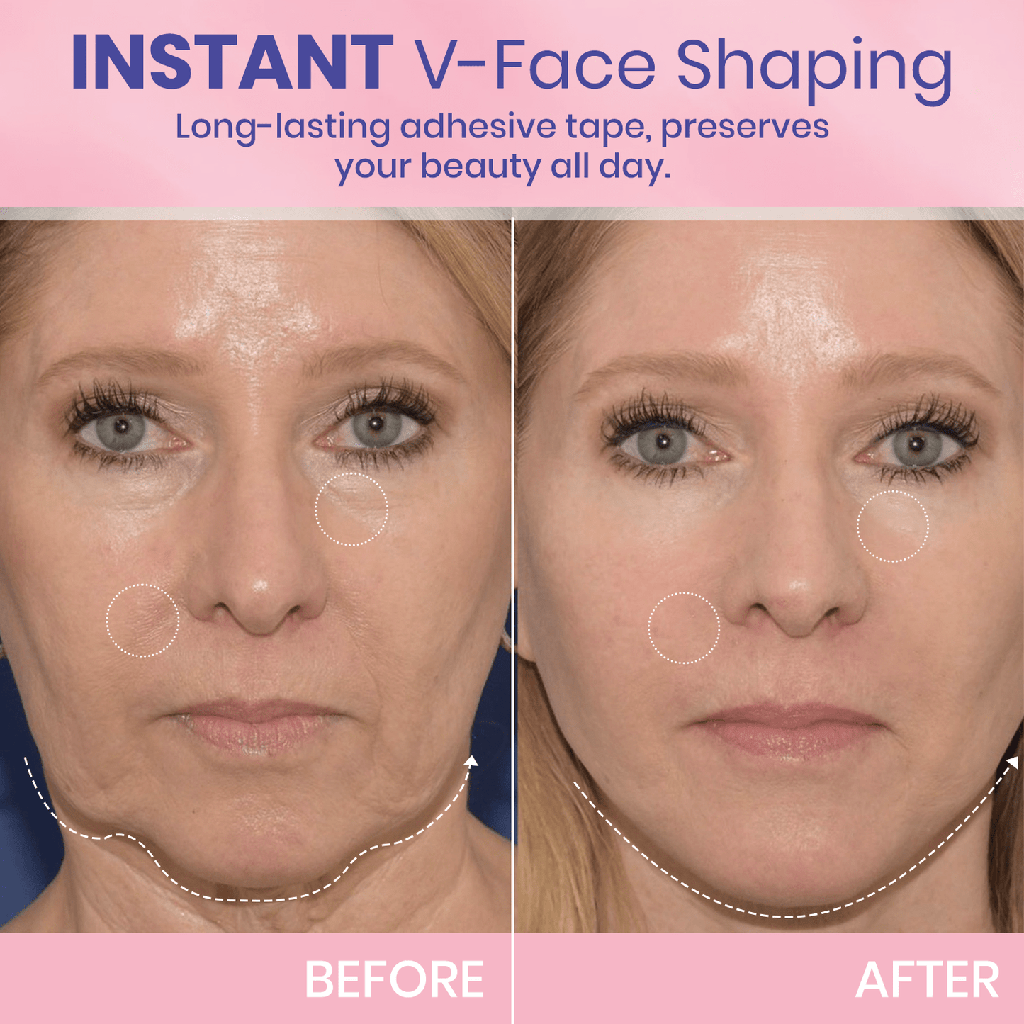InvisiLift™ | Invisible Adhesive Tape for Face Lifting