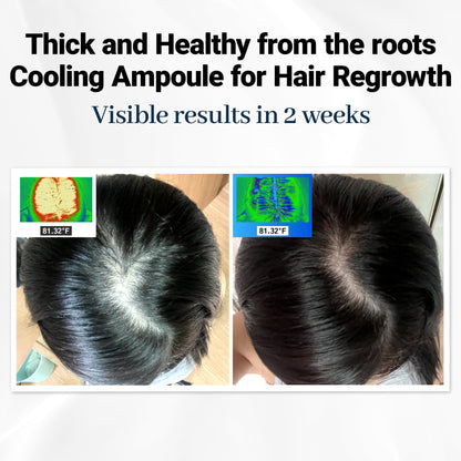 Scalpy™ Cooling Hair Ampoule | Scalp Health & Regrowth
