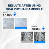 Scalpy™ Cooling Hair Ampoule | Scalp Health & Regrowth