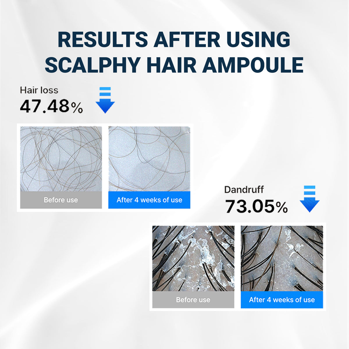 Scalpy™ Cooling Hair Ampoule | Scalp Health & Regrowth