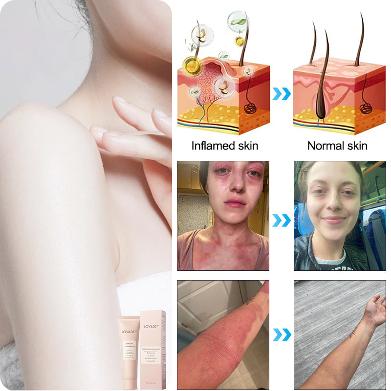 LOVILDS™ | Exfoliating and Brightening Gel