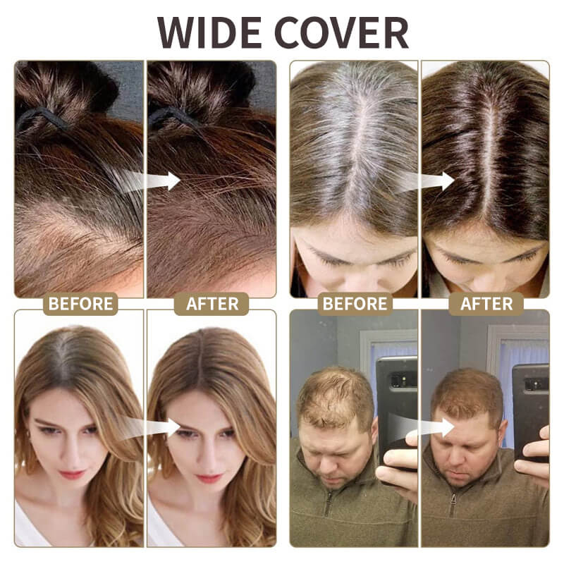 Hairline™ | Upgrade Magic Root Cover Up