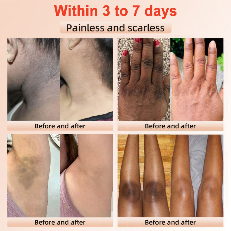 LOVILDS™ | Exfoliating and Brightening Gel