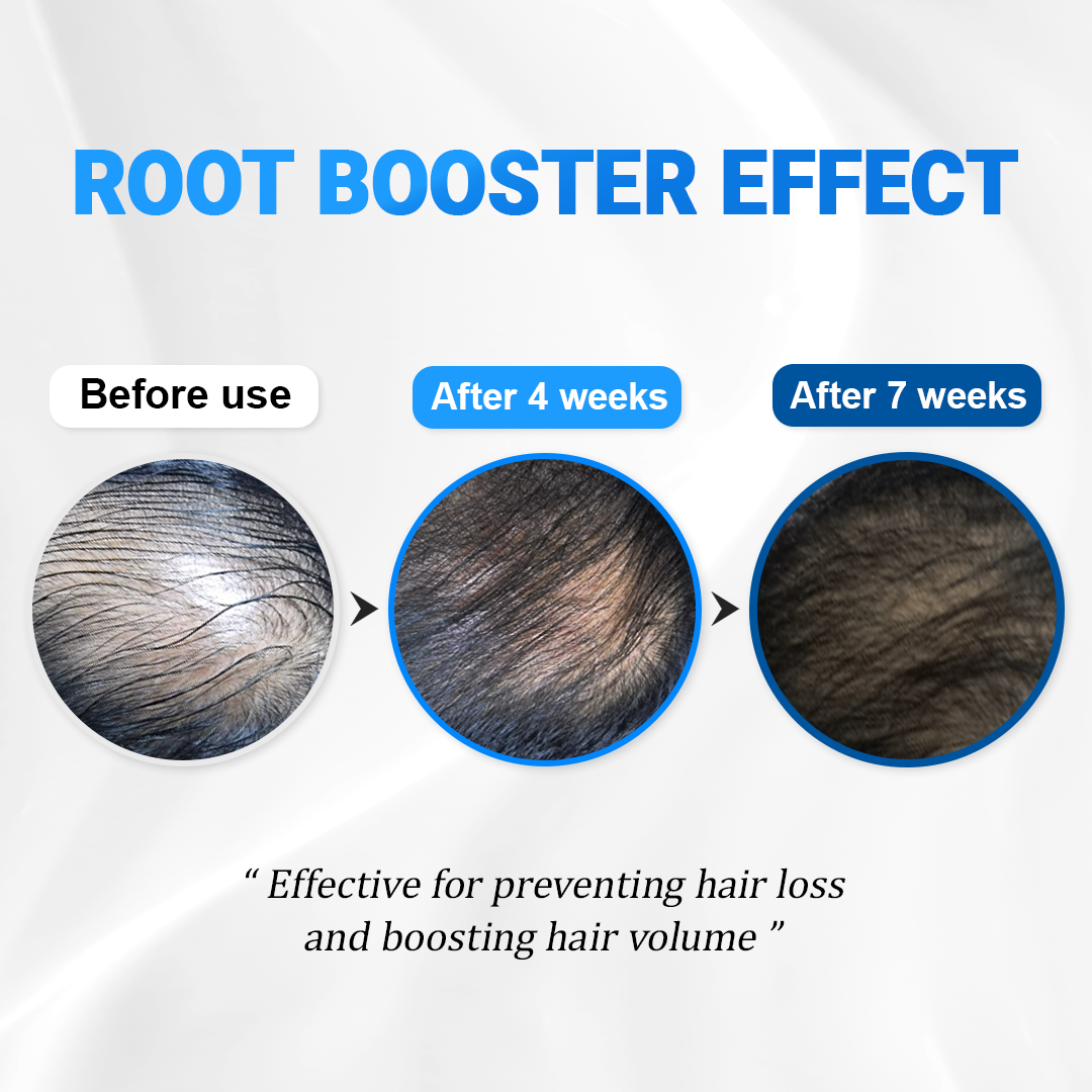Scalpy™ Cooling Hair Ampoule | Scalp Health & Regrowth