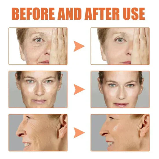 DermaTox | Clostridium botulinum Face Serum