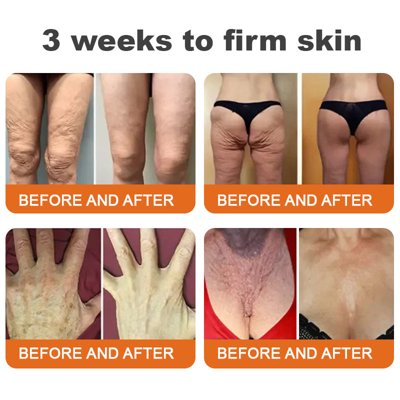 BeeBotox | Anti-Ageing Cream with Bee Venom and Botox