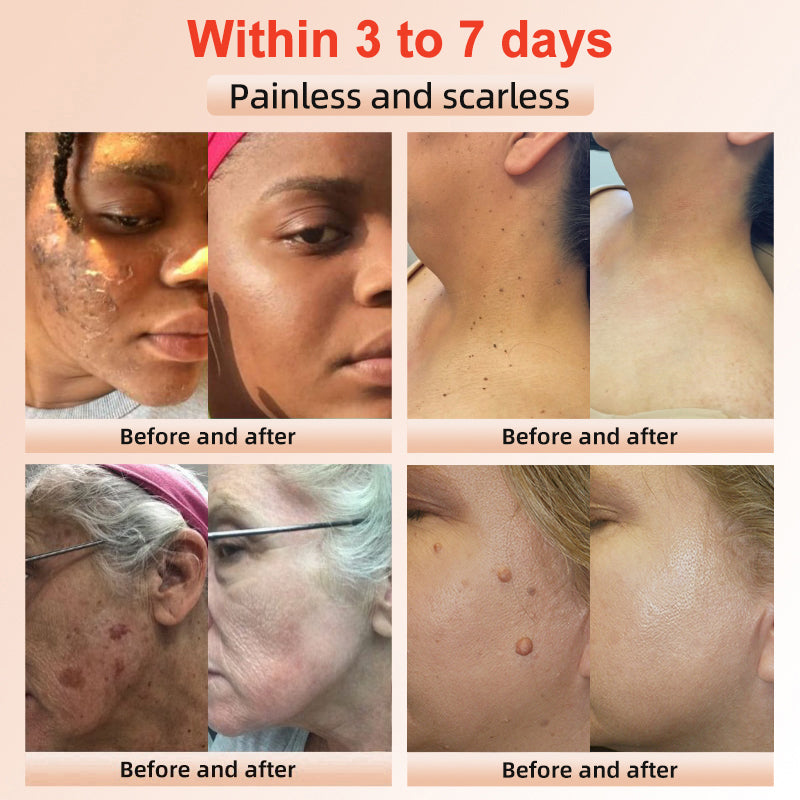 LOVILDS™ | Exfoliating and Brightening Gel
