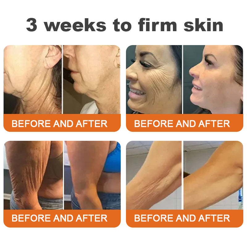 BeeBotox | Anti-Ageing Cream with Bee Venom and Botox