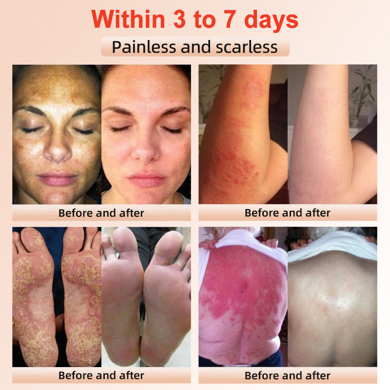 LOVILDS™ | Exfoliating and Brightening Gel