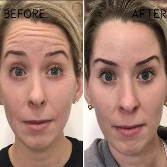DermaTox | Clostridium botulinum Face Serum