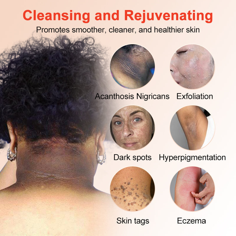 LOVILDS™ | Exfoliating and Brightening Gel