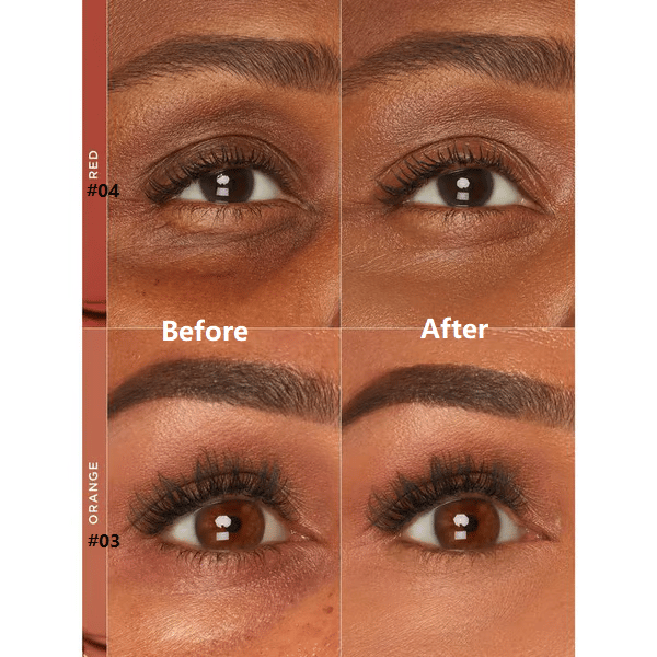 BrightEyes™ - Dark Circle Corrector