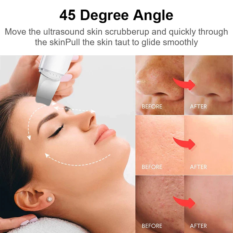 DermaWave™ | Ultrasonic Skin Scrubber with Vibration for the Face