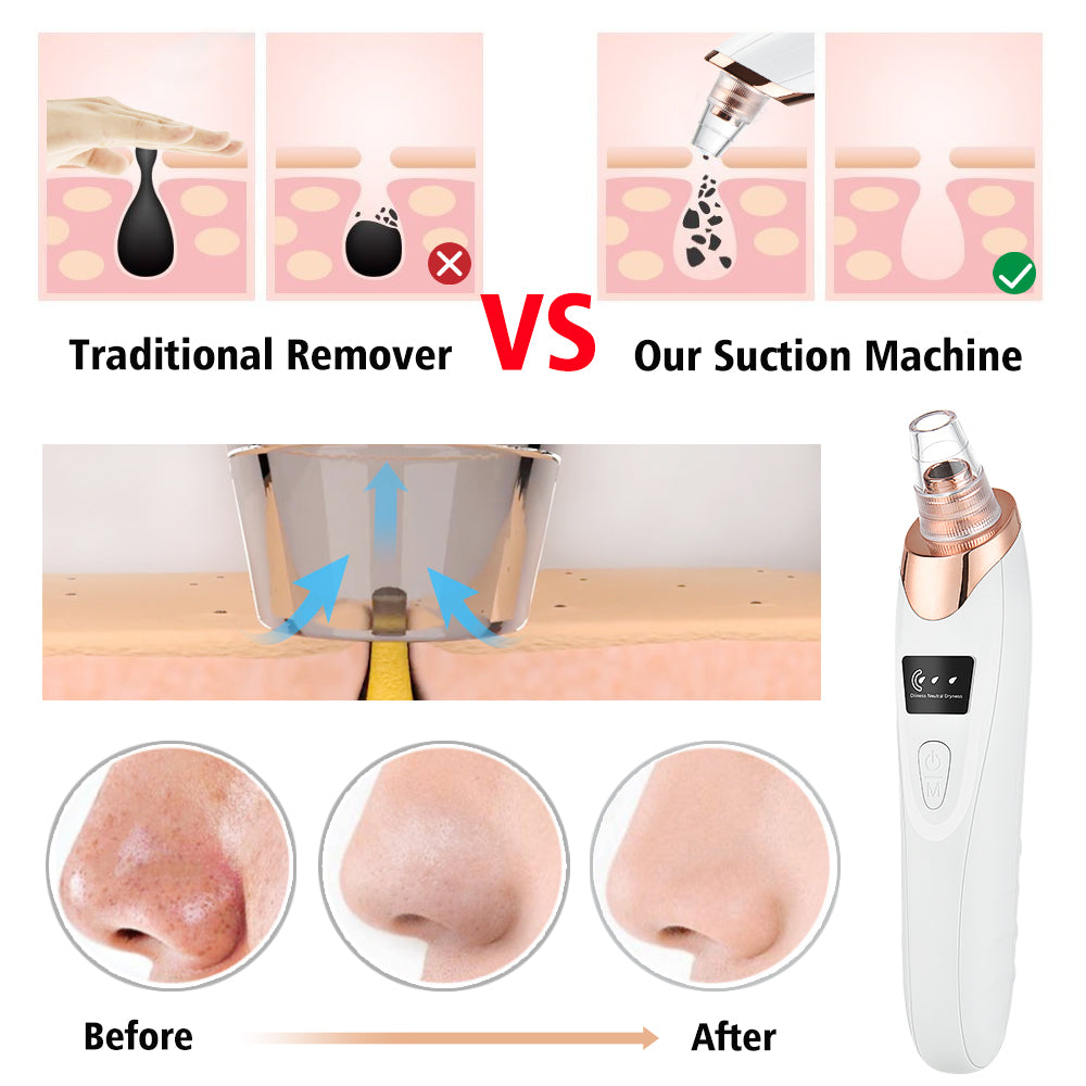 PurePore™ | Electric Facial Pore Vacuum