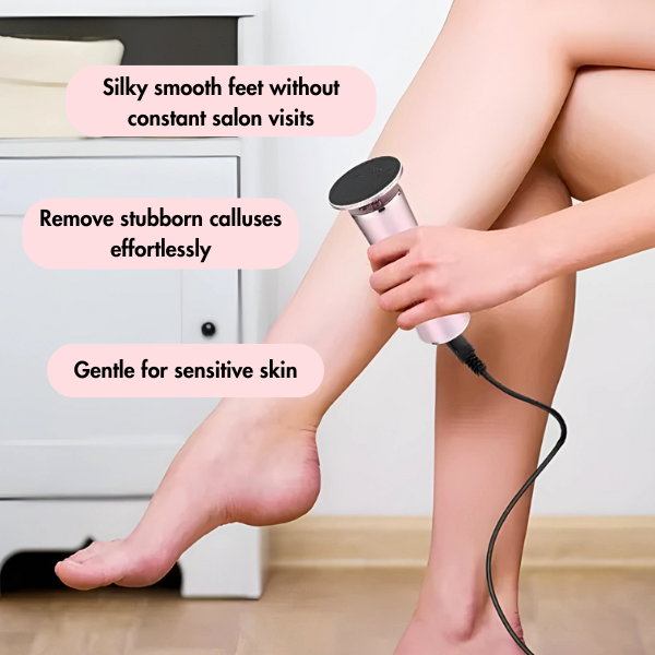 SmoothSole™ | Electric Foot File