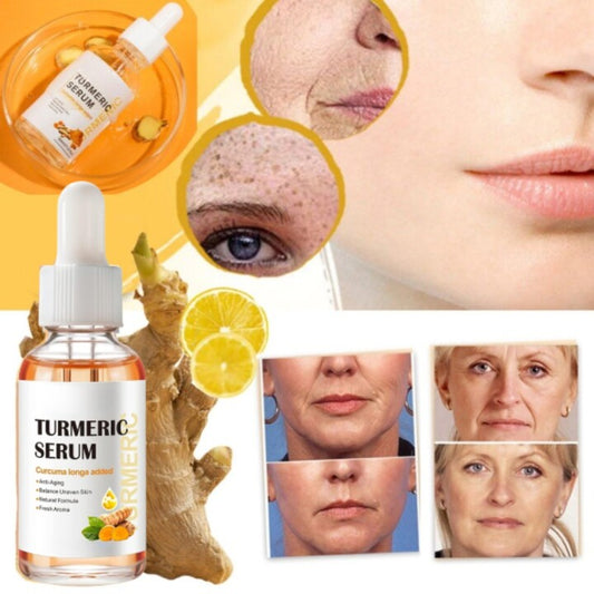 NiaTurm | Turmeric and Niacinamide Serum to Reduce Facial Dark Spots