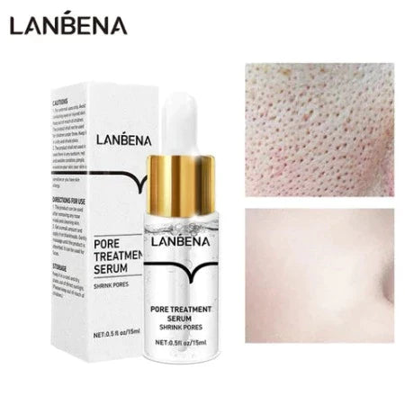 Lanbena™ | Blackhead Mask