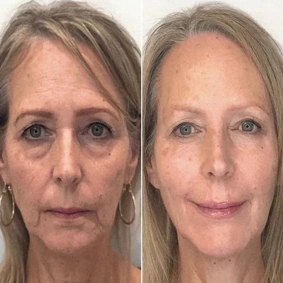 DermaTox | Clostridium botulinum Face Serum