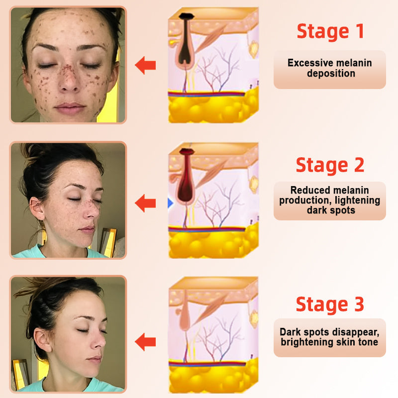 LOVILDS™ | Exfoliating and Brightening Gel