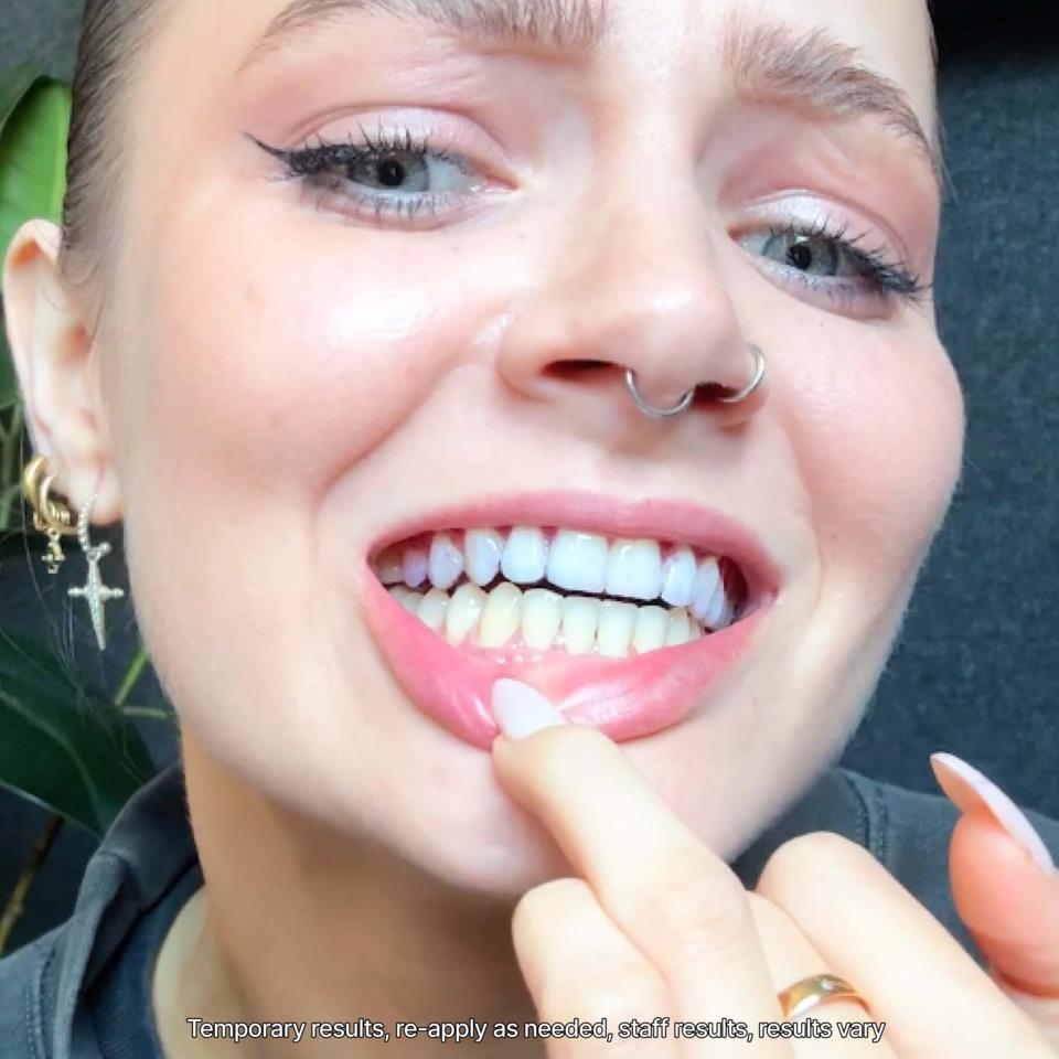 Hismile V34 Whitening Strips